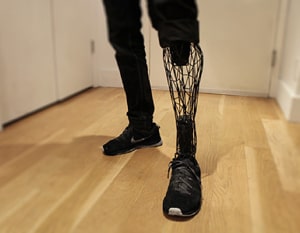 Prosthesis - English Vocabulary in Context with Images at LELB Society from 601 Words
